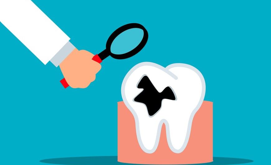 11 Spiritual Meanings of Dreaming of Rotten Teeth