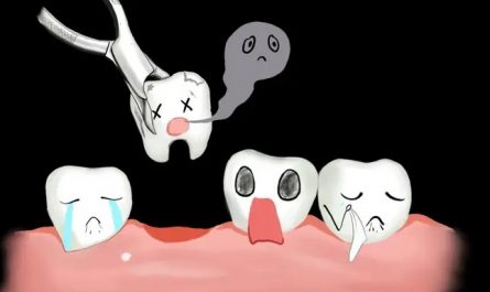 Dreaming of Tooth Extraction