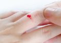 Dreaming of Finger Bleeding