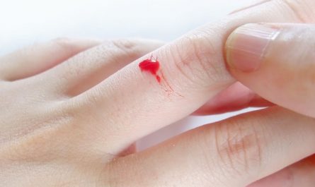 Dreaming of Finger Bleeding