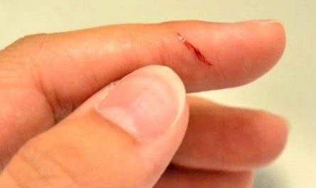 Dreaming of Cutting Fingers