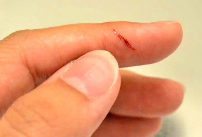 Dreaming of Cutting Fingers