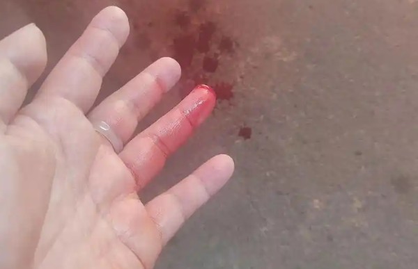 30 Spiritual Meanings of Dreaming of Cutting Fingers