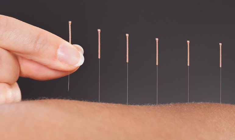 Dreaming of acupuncture clinic