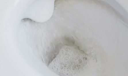 9 symbolic meanings of Dreaming of Stepping in Toilet Feces