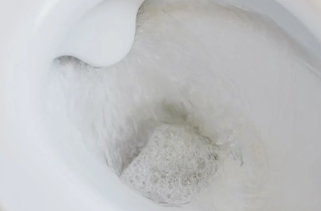 9 symbolic meanings of Dreaming of Stepping in Toilet Feces