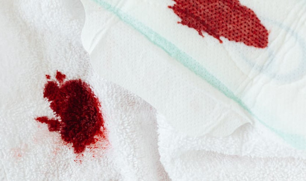 9 Symbolic Meanings of Dreaming of Bloodstained Sanitary Napkins