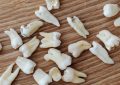 9 Interpretations of Dreaming of Tooth Decay and Pain