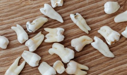 9 Interpretations of Dreaming of Tooth Decay and Pain
