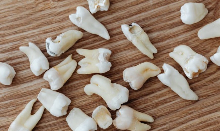9 Interpretations of Dreaming of Tooth Decay and Pain