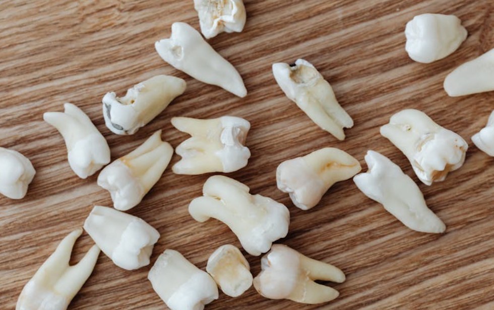 9 Interpretations of Dreaming of Tooth Decay and Pain