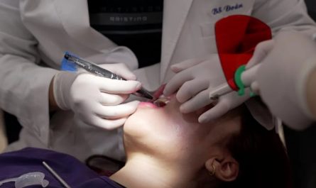 9 Interpretations of Dreaming about Damaged Teeth