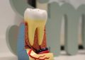 9 interpretations of dreaming about teeth falling out