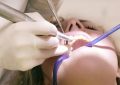 9 Interpretations of Dreaming About Treating Tooth Decay