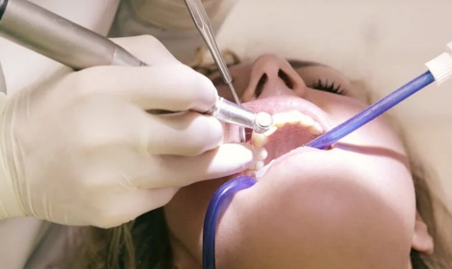 9 Interpretations of Dreaming About Treating Tooth Decay