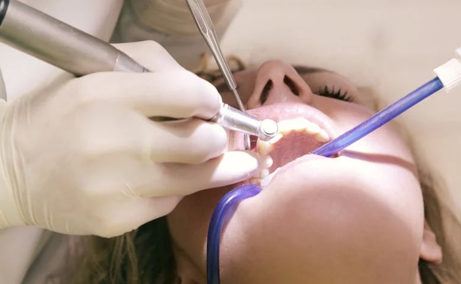 9 Interpretations of Dreaming About Treating Tooth Decay