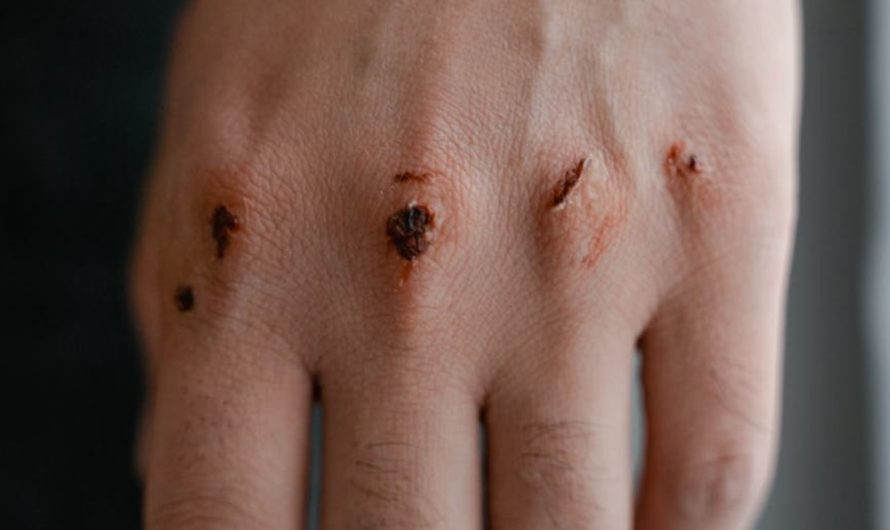9 Spiritual Meanings of Dreaming About Family Members Being Injured